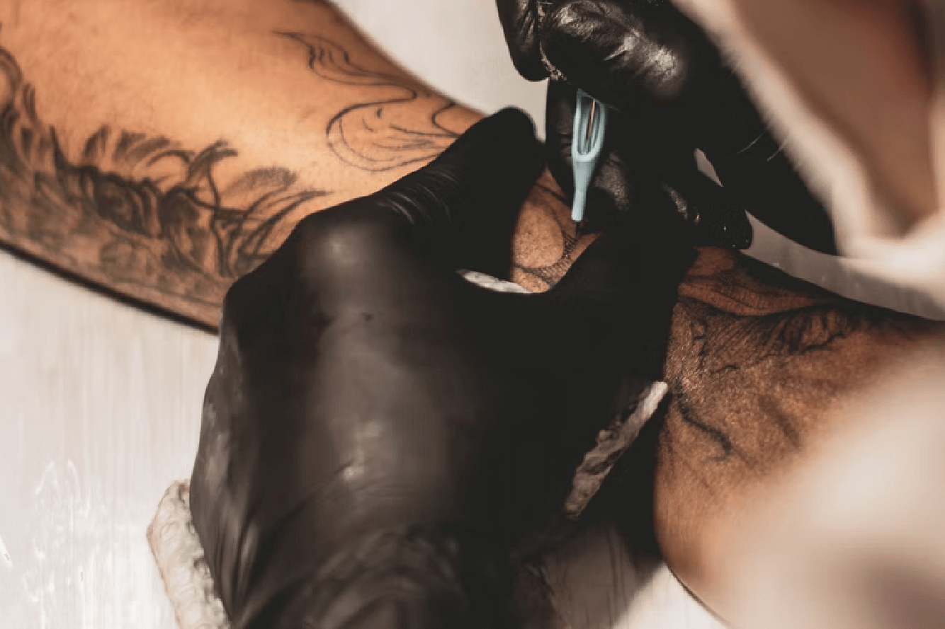 Tattoo Removal Clinics