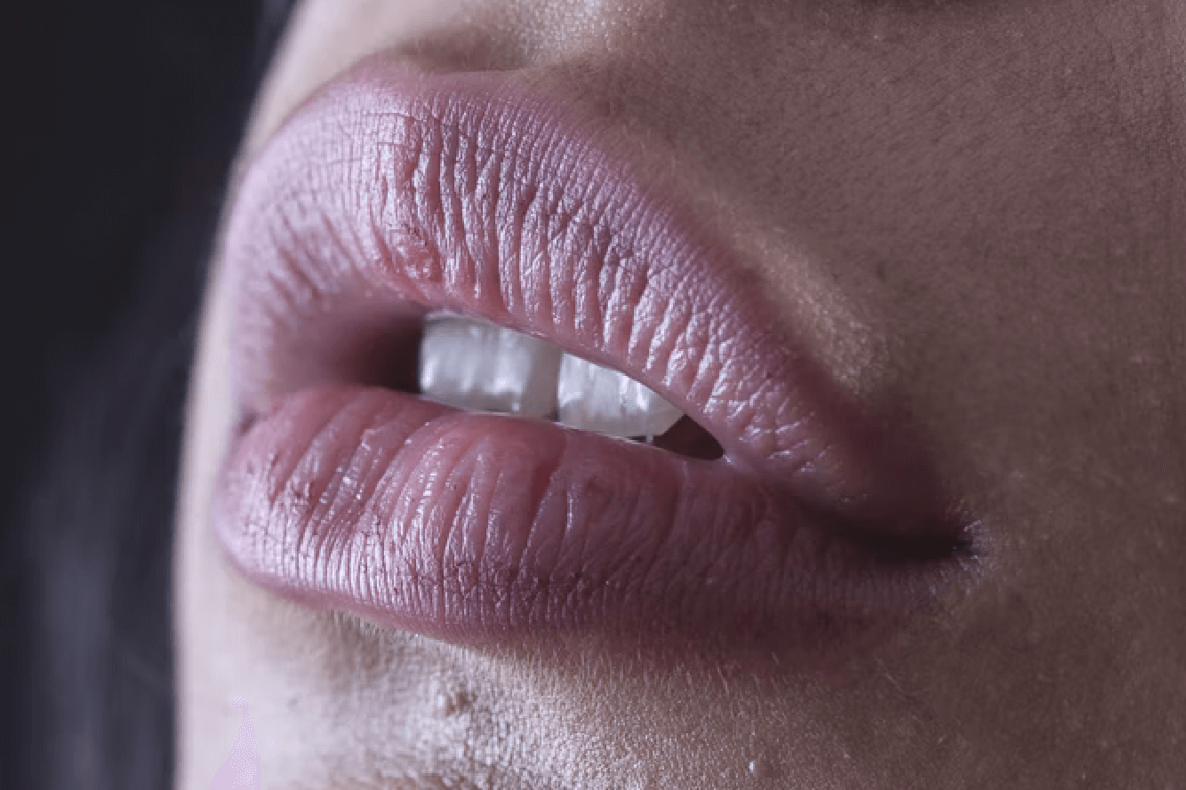 Lip Filler Clinics